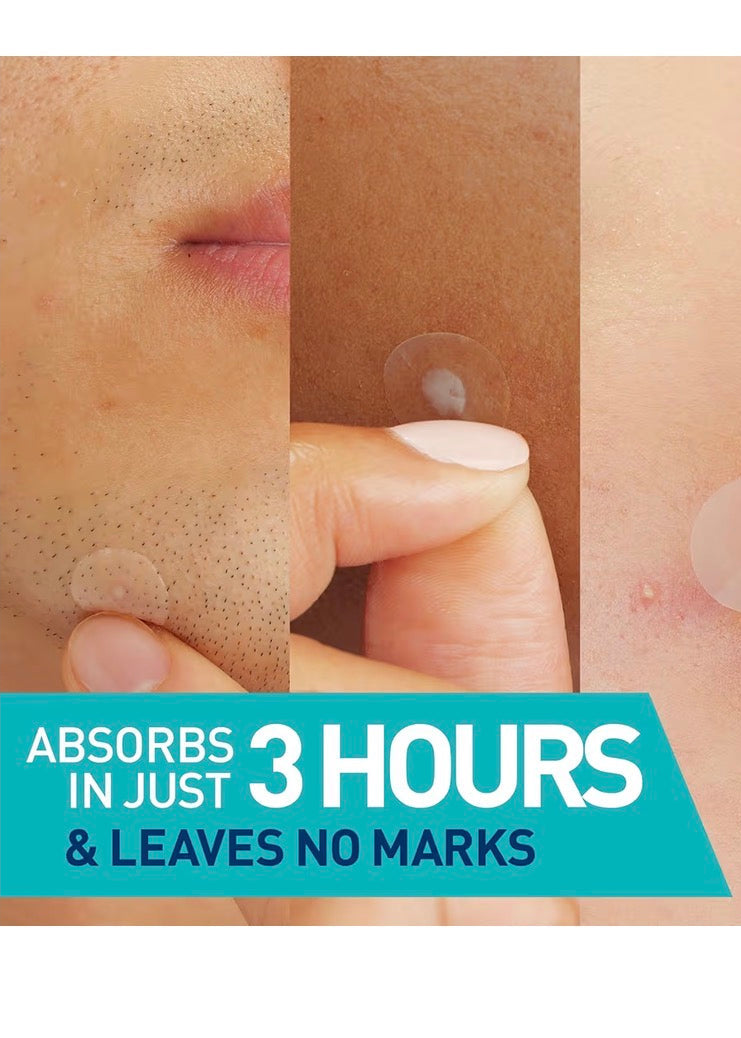 CeraVe Blemish Barrier Patches — 22 Count